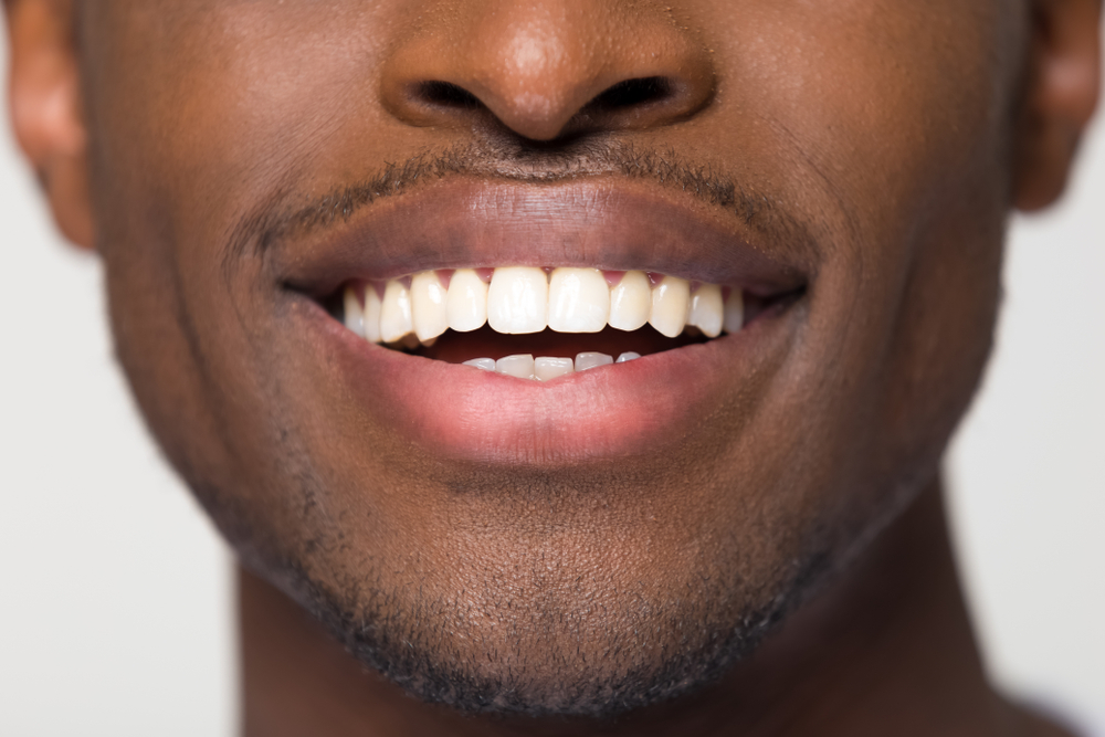 Dental Patient with Nice Smile